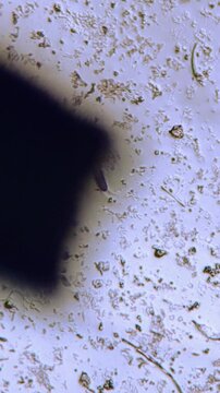 Demodex Mite Lifted from adhesive tape for In Vitro Culturing, Microscopic Footage