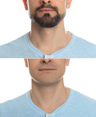 Man before and after shaving on white background, closeup. Collage of photos