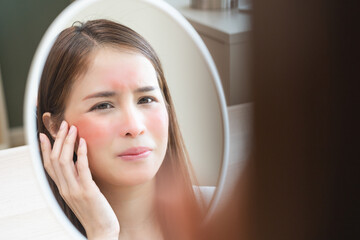 Dermatology, scratch asian young woman looking at mirror, expression worry and itch, itchy allergy...