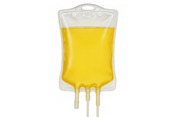 Yellow plasma iv drip bag hanging, medical fluid ready for patient treatment, transparent medical equipment background