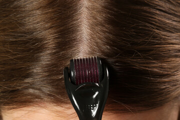 Woman using microneedle derma roller on head for stimulating new hair growth. Simple and cheap...