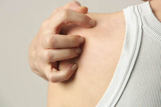Woman scratching shoulder blades, notalgia paresthetica symptom