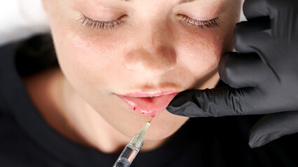Close-up of cosmetologist hands with syringe making beauty injections into lips of young woman....