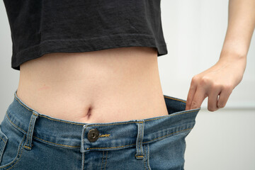 Young Asian woman losing weight wearing loose pants in oversize jeans.