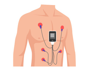 Man Wear Test Holter Monitor portable device tool, Heart's electrical activity (ECG) record, for detection irregular heartbeats (arrhythmias), with man, cable, pad, sensor, data. vector illustration