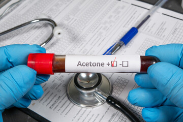 Doctor holding test tube with acetone positive result and stethoscope