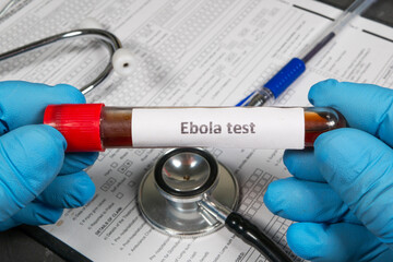 Doctor holding blood sample for ebola test