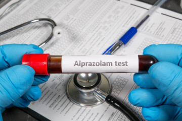 Doctor holding blood sample for alprazolam test