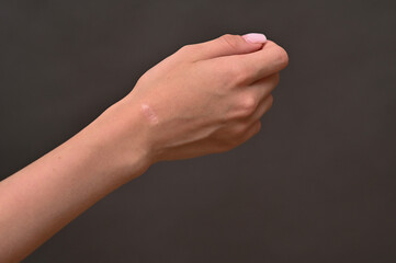 intricate scar details where ganglion cyst was excised. barely noticeable scar represents triumph over chronic wrist pain after successful surgery to remove a benign tumor - hygroma.