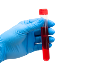 Hand in blue glove holding blood sample test tube isolated on transparent background