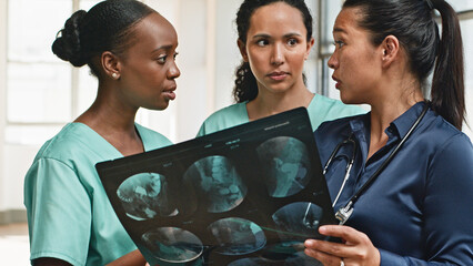 Medical Team Discussing X-Ray Scan in a Professional Clinical Setting