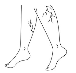 Drawing of  woman's legs with vein diseases. Varicose veins and thrombophlebitis. Linear  vector illustration.