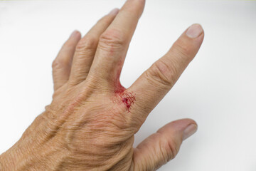 Cut and bleeding male hand on a white