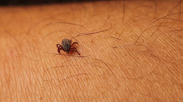 Close-up shot of a parasitic tick crawling on a human hand. A realistic depiction of danger from insect bites and vector-borne diseases, perfect for medical, health, or science projects.