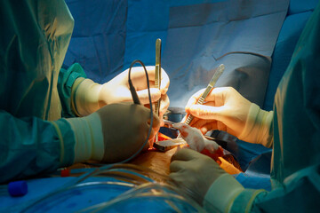 Surgeons intensely during surgical procedure in hospital operating room serious critical operation.