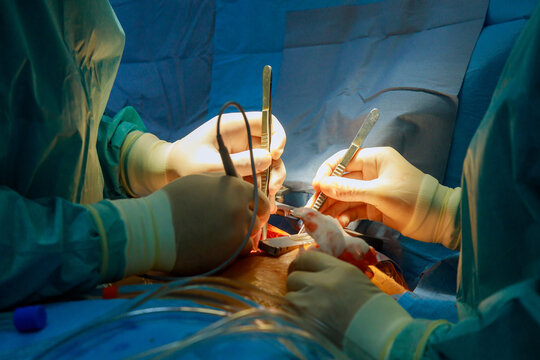 Surgeons intensely during surgical procedure in hospital operating room serious critical operation.