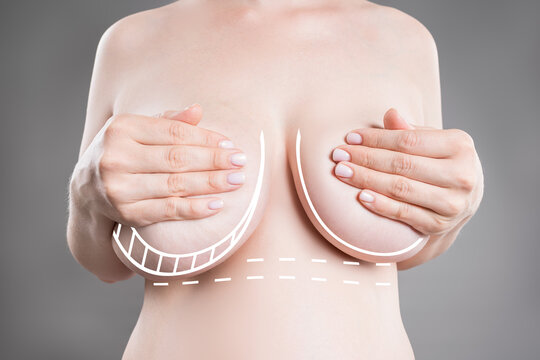 Breasts of different sizes on grey background, reduction mammoplasty, aesthetic plastic surgery, healthcare and medicine concept