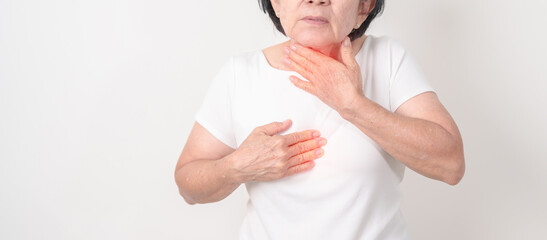 Gastroesophageal Reflux Disease or GERD, Acid reflux disease, Gastro Oesophageal or GORD and...
