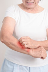 Elderly woman itching arm and body scratching for Skin Allergy from insect bite and food...