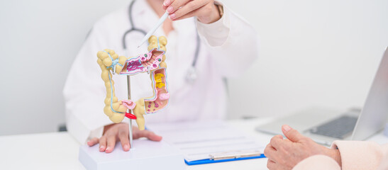 Elderly woman Patient consultation with doctor for Colon disease, Large Intestine, Colorectal...