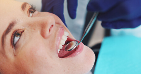 Dental mirror, oral care and dentist with woman for treatment of tooth decay, cavity or...
