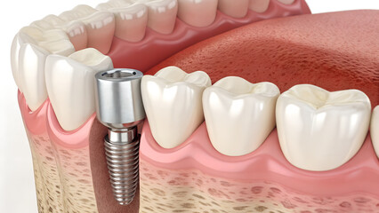 Close-up of a woman's hand holding dental tools for tooth care and hygiene