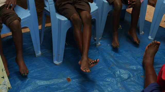 African children with foot infection caused by sand fleas sit on plastic chairs while waiting for medical procedures in room with floor covered with plastic sheeting