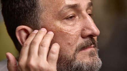 Side view of a bearded middle aged man gently applying a skincare product to his face. Focus on...
