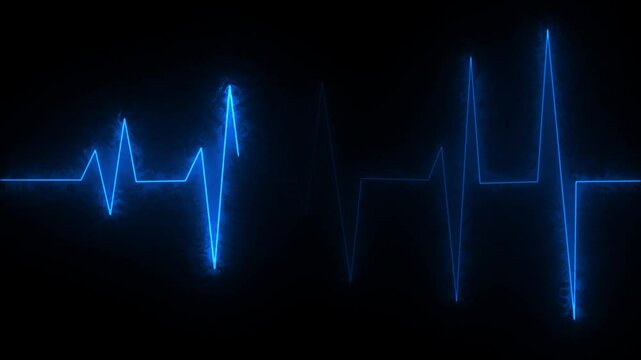 EKG Heartbeat reading animation on black background in 4K. Cardiogram nubes rate ecg waveform surger, Medical monitor displaying cardiography pulse checkup diagnosis electronic screen display machine.