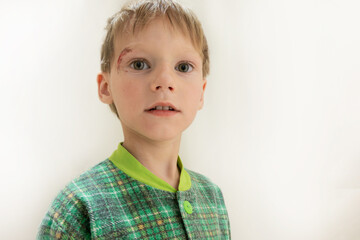 Close-up of the boy's face with a sadina. The child treats the wound on the face. High quality photo