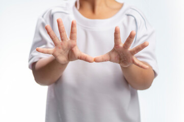 Hand, foot and mouth disease HFMD Human hand of scarlet fever in coxsackievirus palmarosa virus and child hand on white background