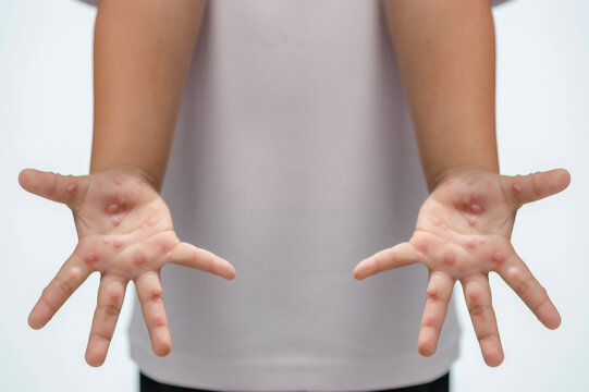 รูปภาพFmd – เลือกดูภาพถ่ายสต็อก เวกเตอร์ และวิดีโอ2,089 | Adobe Stock