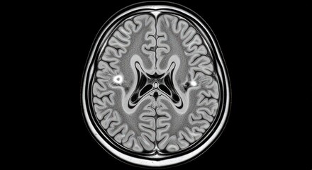 Human Brain Mri Scan with Detailed Anatomical Structures and Bright Lesions in Grayscale Medical Imaging for Diagnosis