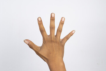 Hands with dirty nails isolated on white background. Dirt under the nails is a source of infection...