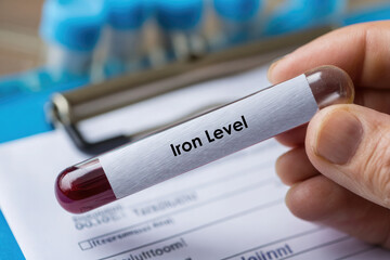 Doctor holding test tube labeled "Iron Level" 