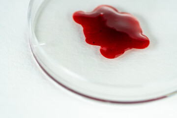 Red color blood droplet in petri dish in pathology science laboratory on white surface as macro