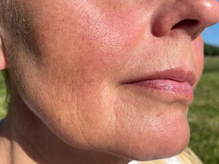 Macro view of mature woman’s cheek and chin skin with wrinkles and natural texture outdoors,...