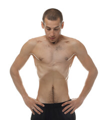 Fototapeta premium Man suffering from anorexia on white background