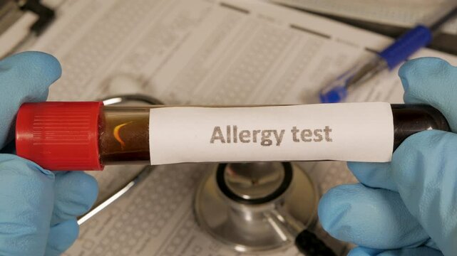 Doctor showing allergy test sample tube