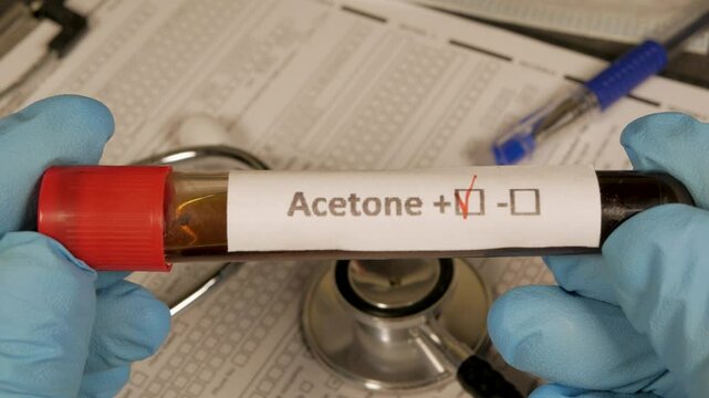 Doctor showing acetone positive test result