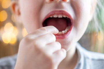 closeup hand child, girl 6 years old points new tooth fang in mouth with finger, children's health,...