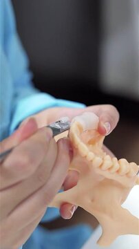 Dental prosthesis in the hands of the doctor close-up. Dentist holding ceramic dental bridge. Front view of complete denture. Dentistry conceptual photo. Prosthetic dentistry. False teeth