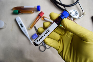Factor VII - Test with blood sample in yellow gloved hands. healthcare or Medical concept