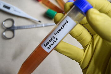 Sexually transmitted infection with blood sample in yellow gloved hands. healthcare or Medical...