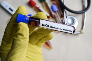 DKA - Diabetic ketoacidosis Test with blood sample in yellow gloved hands. healthcare or Medical...