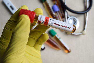 Allergy Specific lgE - Test with blood sample in yellow gloved hands. healthcare or Medical concept