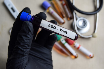 ASO - Test with blood sample in black gloved hands. healthcare or Medical concept