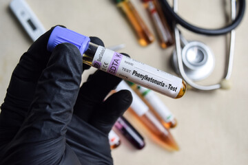 Phenylketonuria - Test with blood sample in black gloved hands. healthcare or Medical concept