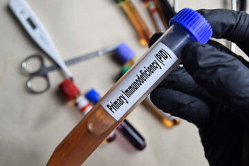 Primary Immunodeficiency - PID - Test with blood sample in black gloved hands. healthcare or...