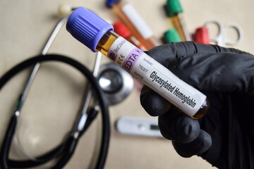 Glycosylated Hemoglobin - Test with blood sample in black gloved hands. healthcare or Medical...